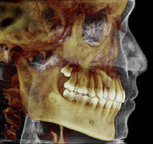 3d-dental-imaging
