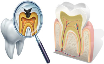 endodonzia