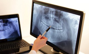 radiologia_odontoiatrica01